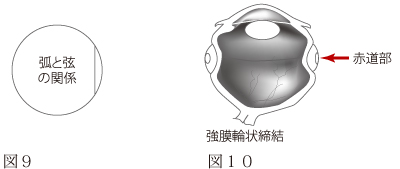 硝子体手術について　図4
