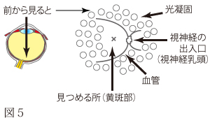 糖尿病網膜症について　図2