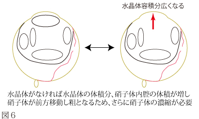 網膜剥離について　図4